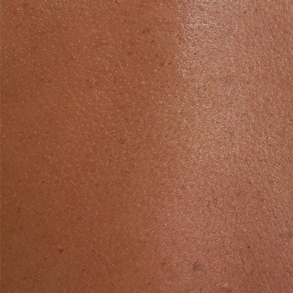Pele alérgica pele sensível e pele reativa