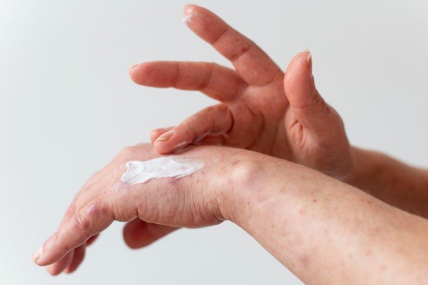 <strong>Dermatite de contacto: causas, sintomas e cuidados</strong>
