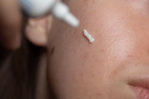 <strong>Hiperpigmentação pós-inflamatória: Tratamentos e causas</strong>