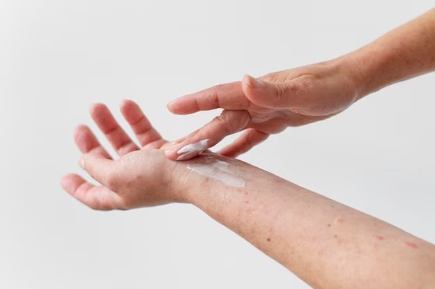 <strong><span>Como tratar a dermatite de stress?</span></strong>