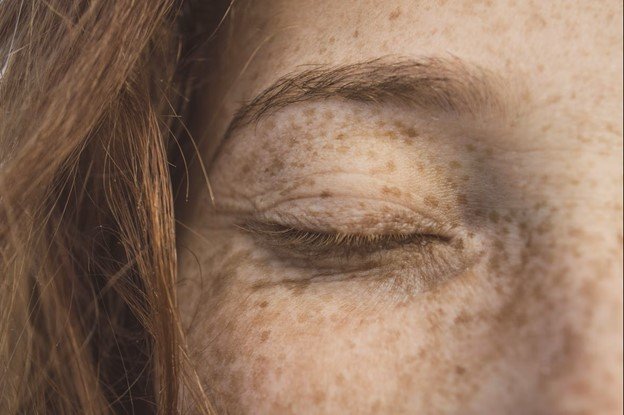 <strong><span>Melanina: O que &eacute;, tipos de melanina e como proteger a sua pele</span></strong>