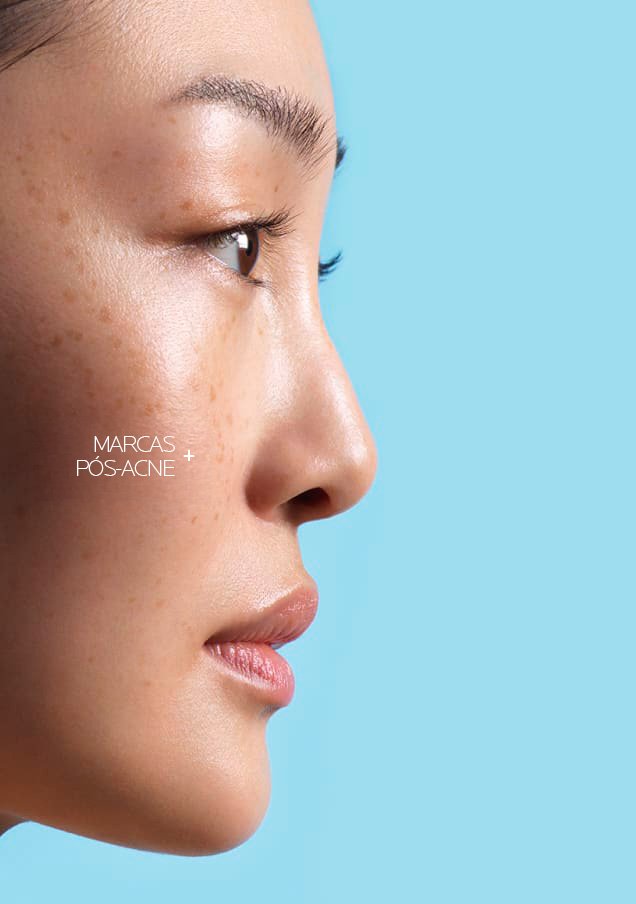 /-/media/project/loreal/brand-sites/lrp/emea/pt/products/effaclar/effaclar-a-z-gel-cream/effaclar-az-gel-creme-pt_3-card.jpg