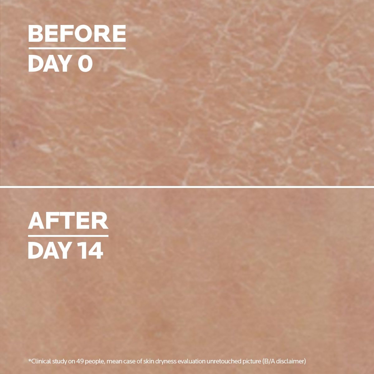 Comparação da pele antes e 14 dias depois de utilizar o Lipikar Lait Urea 10% da La Roche Posay